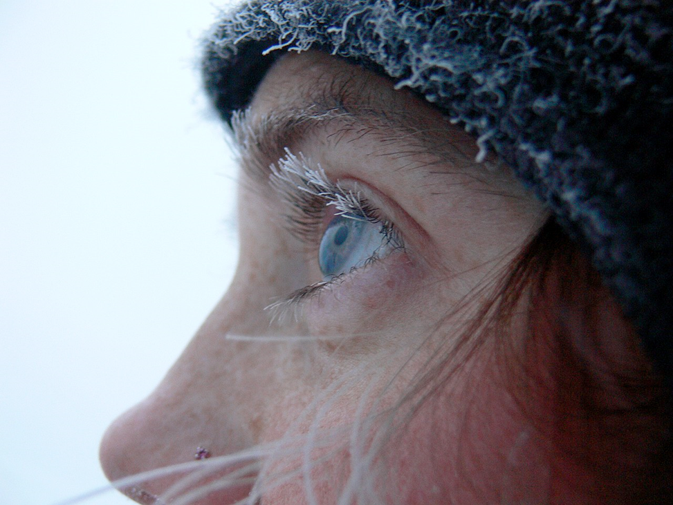 Frozen eyelashes